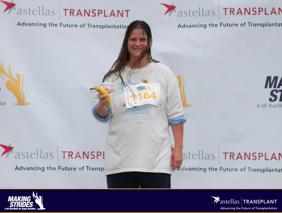 transplant159